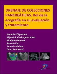 Drenaje de colecciones pancreáticas. Rol de la ecografía en su evaluación y tratamiento