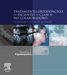 Tratamiento ortodóncico pacientes clase 2 no colaboradores Principios y técnicas actuales