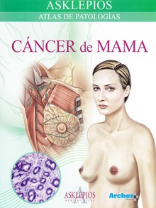 Cáncer de mama atlas de patologías