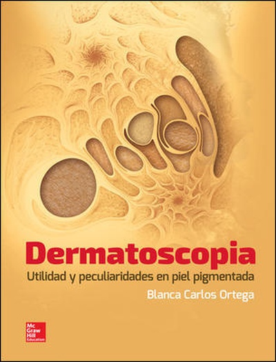 Dermatoscopia utilidad y peculiaridades en piel pigmentada