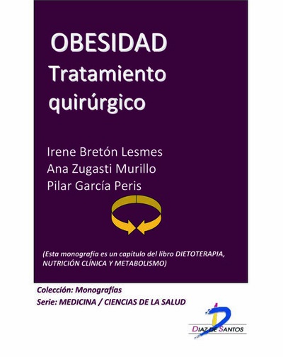 Obesidad. Tratamiento quirúrgico