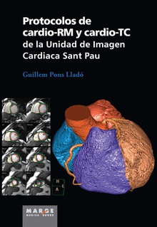 Protocolos de cardio-rm y cardio-tc unidad de imagen cardiaca de sant pau