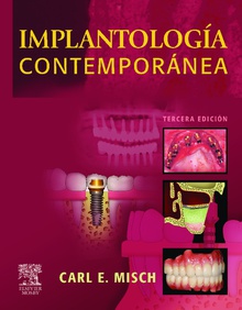 Implantologia contemporanea