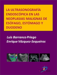 La ultrasonografía endoscópica en las neoplasias malignas de esófago, estómago y duodeno