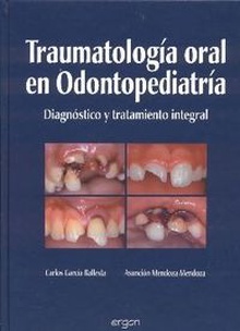 Traumatología oral Diagnóstico y tratamiento integral. Soluciones estéticas.