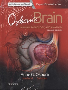 Osborn's brain