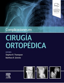 Complicaciones en cirugía ortopédica Medicina deportiva