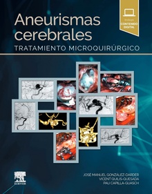Aneurismas cerebrales Tratamiento microquirúrgico