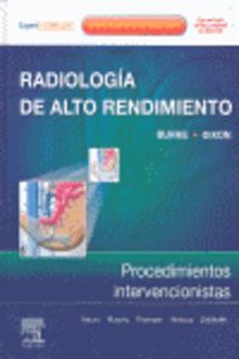 Radiología de alto rendimiento Procedimientos intervencionistas