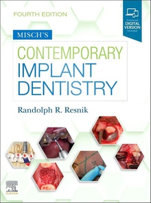 Misch´s contemporary implant dentistry
