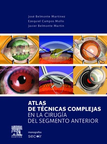 Atlas de técnicas complejas en la cirugía del segmento anterior