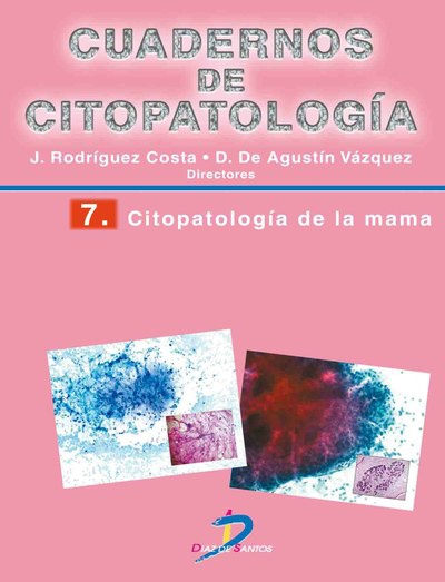 Citopatología de la mama