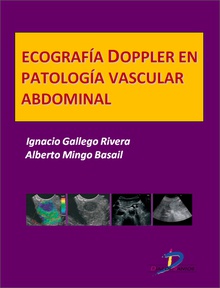 Ecografía Doppler en Patología vascular abdominal