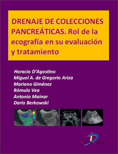 Drenaje de colecciones pancreáticas. Rol de la ecografía en su evaluación y tratamiento