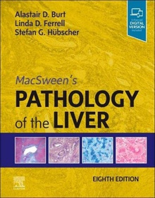 Macsween´s pathology of liver