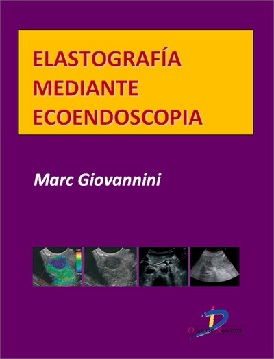 Elastografía mediante ecoendoscopia