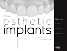 Esthetic Implants How to think about complex cases in anterior areas with a glob