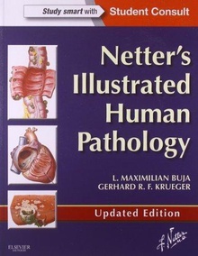 Netter's Illustrated Human Pathology Updated Edition with Student Consult Access