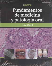 Cawson. fundamentos de medicina y patología oral