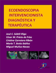 Endoscopia intervencionista diagnóstica y terapéutica