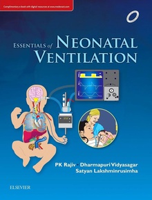 Essentials of neonatal ventilation