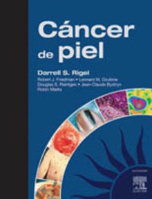 Cáncer de piel