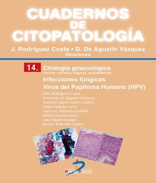 Citología ginecológica Infecciones fúngicas. Virus del Papiloma Humano (HPV)