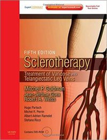Sclerotherapy Treatment of vaicose and telangiectatic leg veins