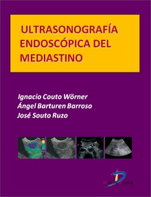 Ultrasonografía endoscópica del mediastino