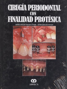 Cirugía periodontal con finalidad protésica