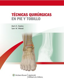 Técnicas Quirúrgicas en Pie y Tobillo