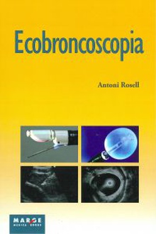 Ecobroncoscopia