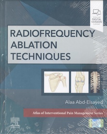 Radiofrequency ablation techniques